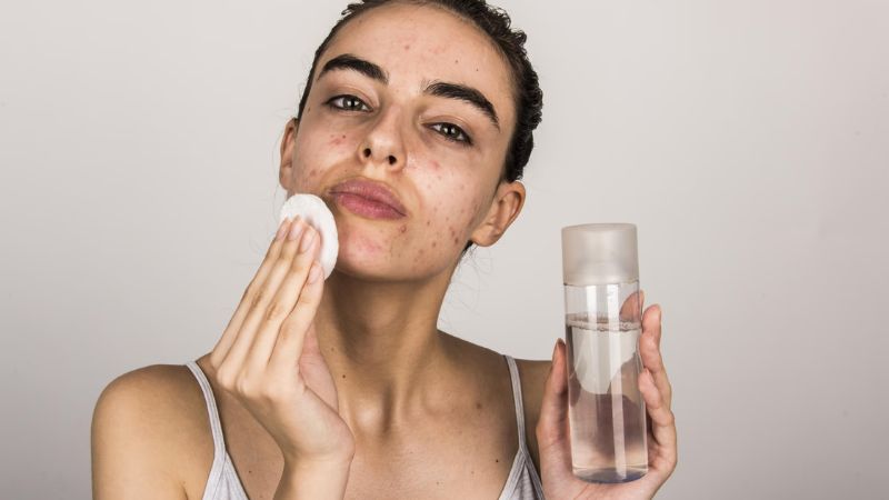 The Ultimate Skincare Routine For Acne Prone Skin